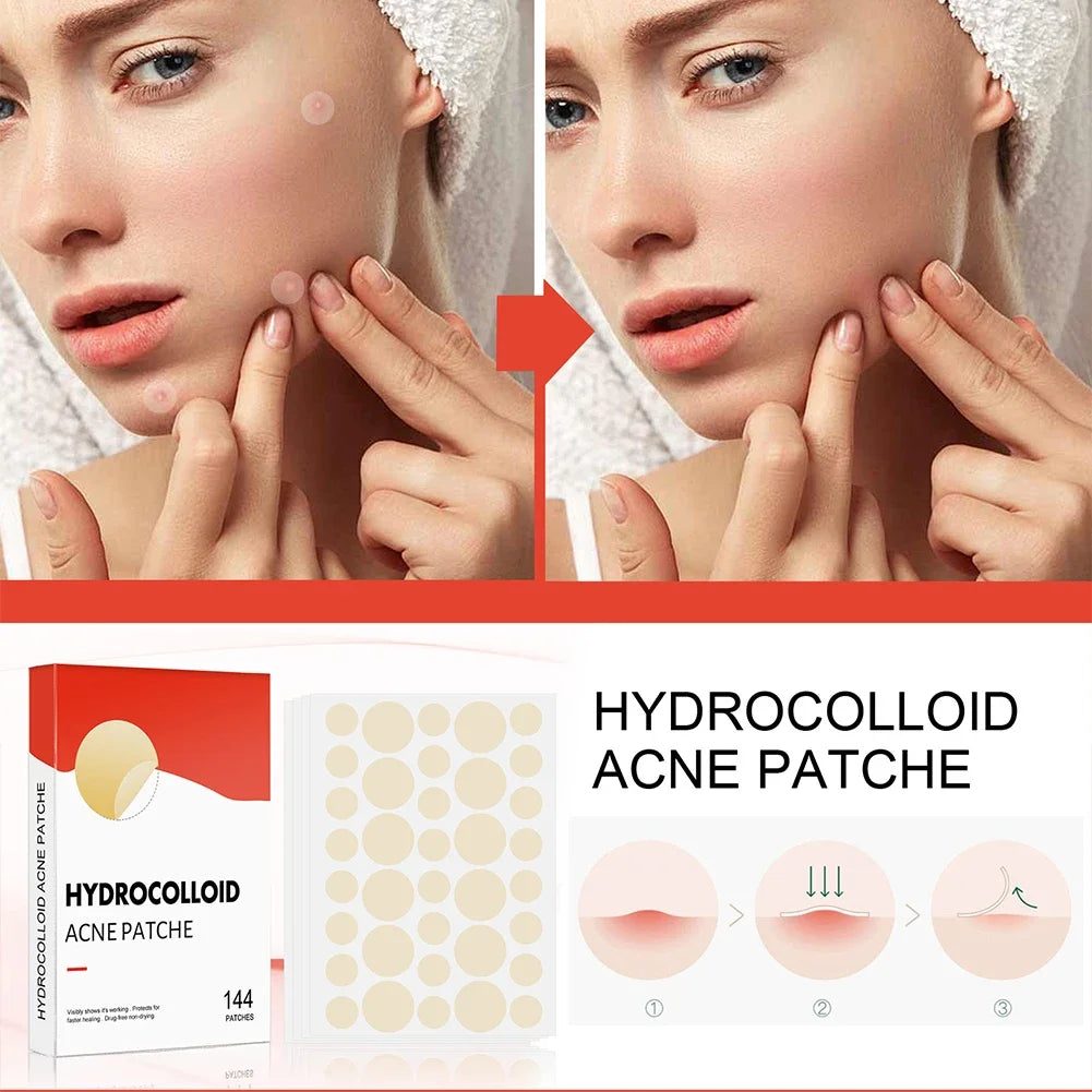 ClearSkin+ Patch - Solution Invisible Anti-Acné